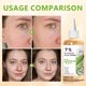 thumbnail image 4 of Tónico hidratante con 7% de ácido glicólico Discoliner, 240 ml, 4 of 7