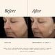 thumbnail image 4 of Serum SkinMedica TNS Advanced+ Face 30 ml para arrugas, 4 of 9