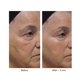 thumbnail image 3 of Borrador Wrinkle Lost Line Reducer Dr. Denese de 3 minutos, 3 of 4