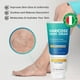 thumbnail image 3 of Crema Hermon para varices para piernas, 150 ml, fabricada en Italia, 3 of 3