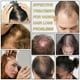 thumbnail image 2 of Sérum para el crecimiento del cabello Peesnb 5% Minoxidil para hombres y mujeres, 2 of 3