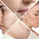 thumbnail image 4 of Rejuvenate Your Skin with Derma Roller 540 Micro Needle - 0.5mm to 3.0mm Skincare Tool, 4 of 4
