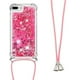 thumbnail image 1 of Funda FOXDOCK para iPhone 7 Plus/8 Plus con Cuerda Ajustable, Brillo Líquido, Protección Antigolpes y Lente – Ideal para Regalo, 1 of 6