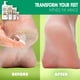 thumbnail image 5 of Crema Reparadora Para Pies 120 Ml (paquete De 2), 5 of 7