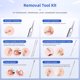 thumbnail image 3 of Kit Extractor de Puntos Negros Shelvestar de Acero Inoxidable, 3 of 3