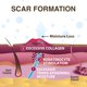 thumbnail image 4 of Parche de silicona para cicatrices Biodermis Epi-Derm 2 x 2.5 pulgadas (1 par), 4 of 7