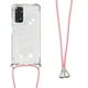 thumbnail image 2 of Funda FOXDOCK para Xiaomi Redmi Note 11/11s 4G con Cuerda Ajustable, Brillo Líquido, Protección Antigolpes y Lente – Ideal para Regalo, 2 of 6