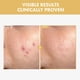 thumbnail image 2 of Sérum TOSOWOONG Black Snail Ginseng 30 ml con mucina de caracol, 2 of 6