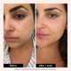 thumbnail image 4 of Suero Facial Innbeauty Project 30 ml 1 % Retinol, 4 of 4