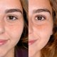 thumbnail image 2 of Kit de estiramiento de pestañas LIVIA Instant Quality Curls x3 Apps, 2 of 9