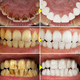 thumbnail image 3 of V34 Purple Toothpaste Teeth Whitening Enzyme Remove Plaque Stains Oral Hygiene Cleaning Dental Tools Fresh Breath Beauty Health, 3 of 3