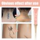 thumbnail image 3 of Crema de eliminación de tatuajes KLSychry Fast Permanent sin cicatrices, 13 g, 3 of 7