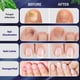 thumbnail image 4 of Tratamiento para hongos en las uñas de los pies Tobcharm Extra Fuerte 60 ml, 4 of 7