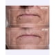 thumbnail image 4 of Parche antiarrugas Wrinkles Schminkles 3 pares + 2 unidades, 4 of 8