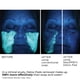 thumbnail image 4 of Almohadillas faciales NassifMD Detox con ácido glicólico, 30/60 unidades, 4 of 7