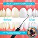 thumbnail image 4 of Raspador de Sarro Dental Utopia Care 16,5 cm Herramienta Negra, 4 of 6