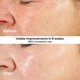 thumbnail image 5 of Kleem Hidratante Facial con Retinol - Crema Nocturna Antienvejecimiento Reafirmante 1,7 oz (50 ml), 5 of 9