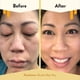 thumbnail image 4 of Crema facial ECZEMA HONEY, calmante para eccema, 60 ml, para rostro, 4 of 6