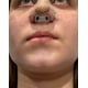 thumbnail image 5 of Nostril Retainer para pies de forma saludable, 100% silicona de alta calidad, 5 of 8