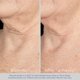 thumbnail image 2 of Concentrado de estiramiento de piel Obagi ElastiDerm para cuello y escote, 2 of 9