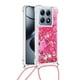 thumbnail image 2 of Funda FOXDOCK para Xiaomi 14T con Cuerda Ajustable, Brillo Líquido, Protección Antigolpes y Lente – Ideal para Regalo, 2 of 6