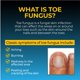 thumbnail image 4 of Pomada antifúngica Fungi-Nail mata hongos, 20 ml con tolnaftato, 4 of 7