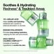 thumbnail image 3 of Serum ANUA Azelaic Acid 10 Hyaluron Redness Soothing 30mL, 3 of 3