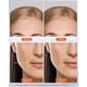 thumbnail image 3 of Mascarilla facial LED de terapia de luz NEWKEY, luz roja para arrugas, 3 of 8