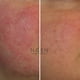 thumbnail image 3 of Crema para Pieles Delicadas - Antirojeces - Calmante e hidratante, 3 of 4