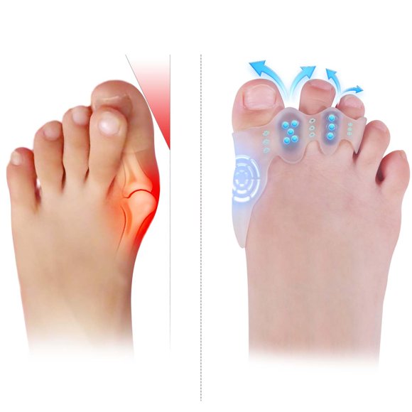 Separadores de Dedos Tevezo Talla Pequeña para Niños - Corrector de Juanetes