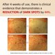 thumbnail image 3 of Suero facial MAKEP:REM 40 ml - Tratamiento de manchas oscuras, 3 of 7