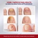 thumbnail image 5 of Tratamiento para Hongos en las Uñas Treatonic 25% Ácido Undecilénico 30 ml, 5 of 9