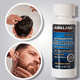 thumbnail image 3 of Mimoxidil Kirkland Cremiento De Barba (1 Mes) 60ml + Gotario, 3 of 4