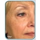 thumbnail image 4 of Crema de terapia biológica con células madre 30 ml, 4 of 4