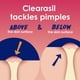 thumbnail image 3 of Limpiador facial Clearasil Rapid Rescue tratamiento profundo para el acné 200 mL, 3 of 9