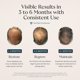 thumbnail image 3 of Serum Capilar Happy Head 60 ml Procapil Biotin Leave-In, 3 of 3