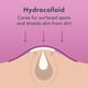 thumbnail image 4 of Pimple Patches Rael Miracle Overnight Spot, 52 unidades, 4 of 9