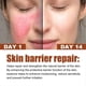 thumbnail image 3 of Instant Repair Facial Redness Cream Soothing Red Blood Rosacea Treatment Improve Sensitive Skin Moisturizer Skin Care Cosmetics, 3 of 3