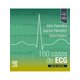 thumbnail image 1 of 160 casos de ECG de Editorial Elsevier, 1 of 5