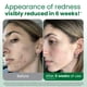 thumbnail image 2 of Toallas faciales CLEAN SKIN CLUB para piel sensible XL, 100 unidades, 2 of 9