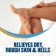 thumbnail image 2 of Crema para Pies Medicada Gold Bond 113 ml, 2 of 9