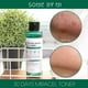 thumbnail image 3 of Tónico Coreano Con Aha Para Pieles Sensibles Y Propensas Al Acné, 30 Days Miracle Toner 150ml -, 3 of 3