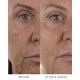 thumbnail image 4 of Suero Noble Panacea 7 Dosis Renovación Intensa, 4 of 8