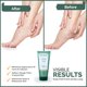 thumbnail image 4 of Crema para pies Moraz Caftan Polygonum 100 ml para pies secos y agrietados, 4 of 8