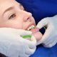 thumbnail image 4 of Paquete de 3 Tiras de Pulido Dental Ceonam 4 mm x 6 m, 4 of 8