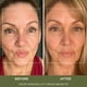 thumbnail image 4 of Crema facial NOOR HAIR Wonder Lift antiedad 30 ml, 4 of 9