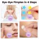 thumbnail image 5 of Parches para espinillas Amifiy Cute Korean Skincare Acne, 40 unidades, 5 of 6