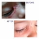 thumbnail image 3 of Barra De Tratamiento De Cicatrices Pro sil Spf 15 4 25 G, 3 of 9