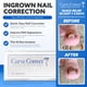 thumbnail image 4 of Kit de tratamiento para uñas encarnadas CurveCorrect con 10 aparatos de ortodoncia transparentes, 4 of 8