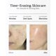thumbnail image 2 of Suero facial BLANC DUBU 11 ml x 3 unidades Ampolla de Idebenona, 2 of 6